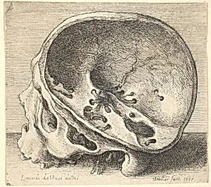 Sectioned skull in profile to left with the left side of the cranium removed by Leonardo da Vinci|Wenceslaus Hollar