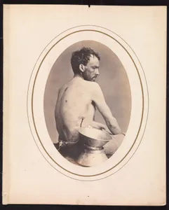 Corporal Israel Spotts, Company G, 200th Pennsylvania Volunteers