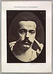 Figure 16: Expression of severity 