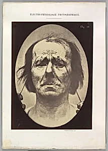 Figure 20: Profound suffering, with resignation