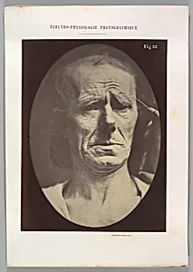 Figure 22: No painful expression 