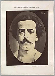 Figure 4: The face in repose of a young man 