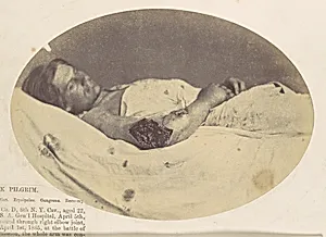Frederick Pilgrim