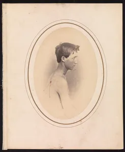 Private Jacob F. Simmons, Company H, Eighty-second Pennsylvania Volunteers