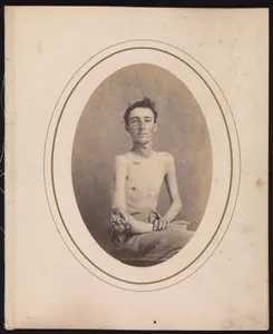 Private James H. Stokes, Company H, 185th New York Volunteers