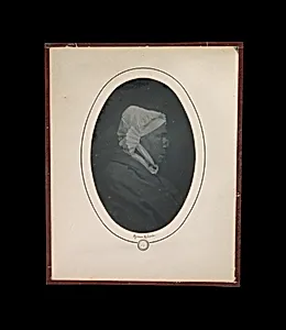 [Profile of a Woman with Necrosis of the Nose]