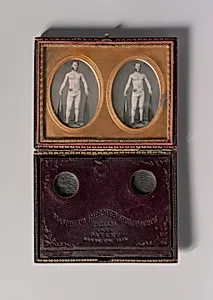 [Stereoscopic Case, Partially Nude Strongman Holding Indian Clubs] by Unknown