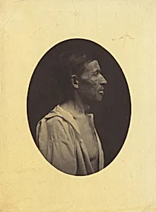 A portrait, seen in profile, of a man 42 years old, stupefied by the abuse of alcohol; his nose is aquiline