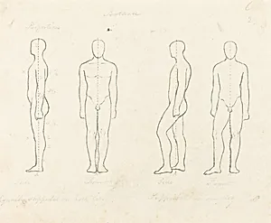Extent of Motion, Front and Side View Equipoised, Supported on One Leg by George Scharf after John Flaxman