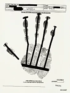 PALM, FINGERS & FINGERTIPS (RIGHT HAND) 000394