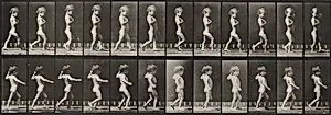 Plate Number 540. A: Bowlegs, boy. B: Spinal caries, girl walking by Eadweard Muybridge