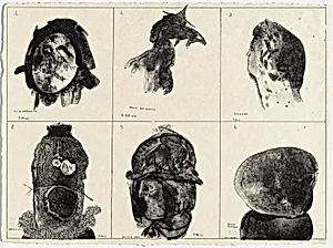 Tortured Ones from Charenton