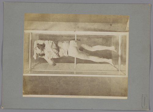 (Museo) Cadavere di donna