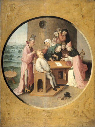 'Removing the Rocks in the Head'