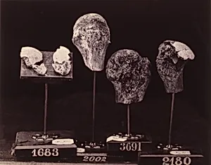 Heads and Fragments of Heads of Humeri, from the Photographic Catalogue of the Surgical Section