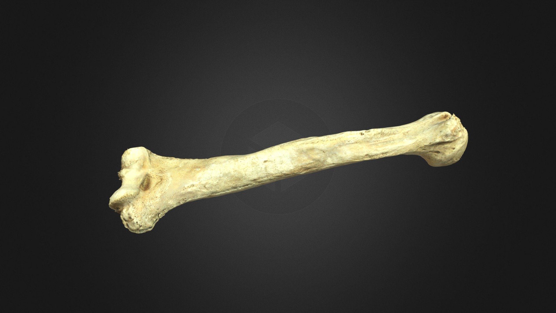 Human Humerus Bone