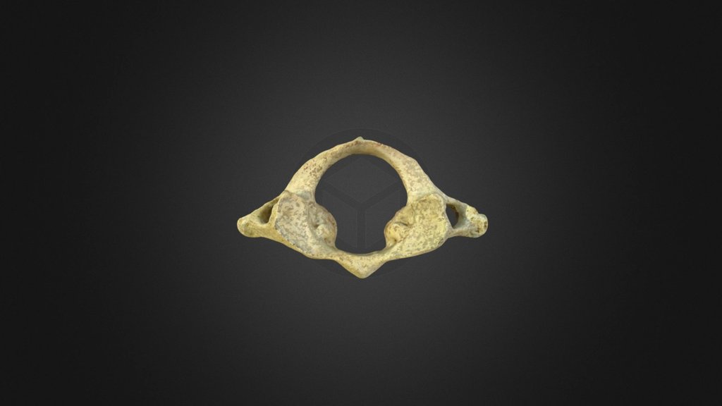 First Cervical Vertebra