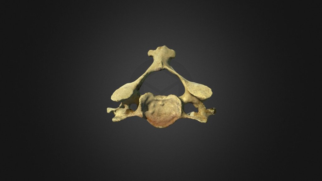 Fourth Cervical Vertebra