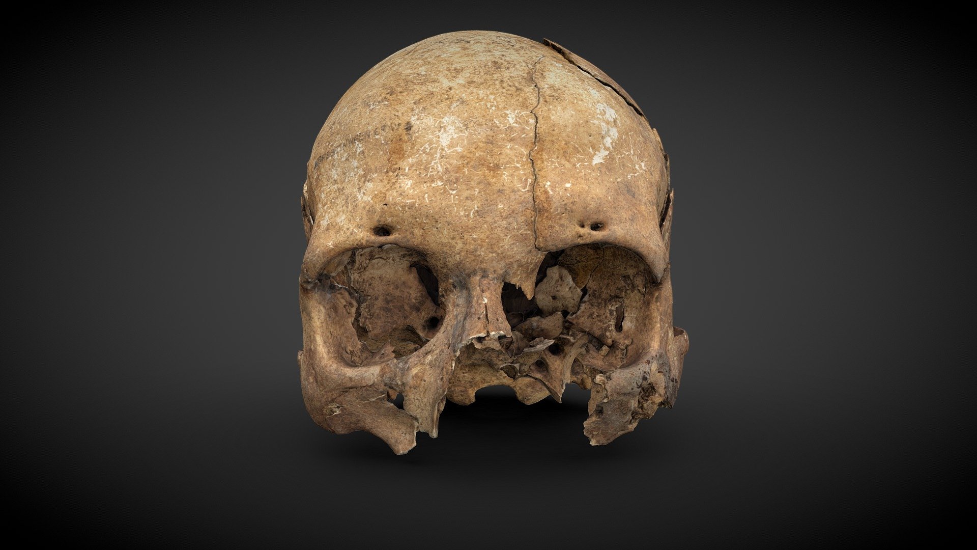 Cranium with injuries - 1089125