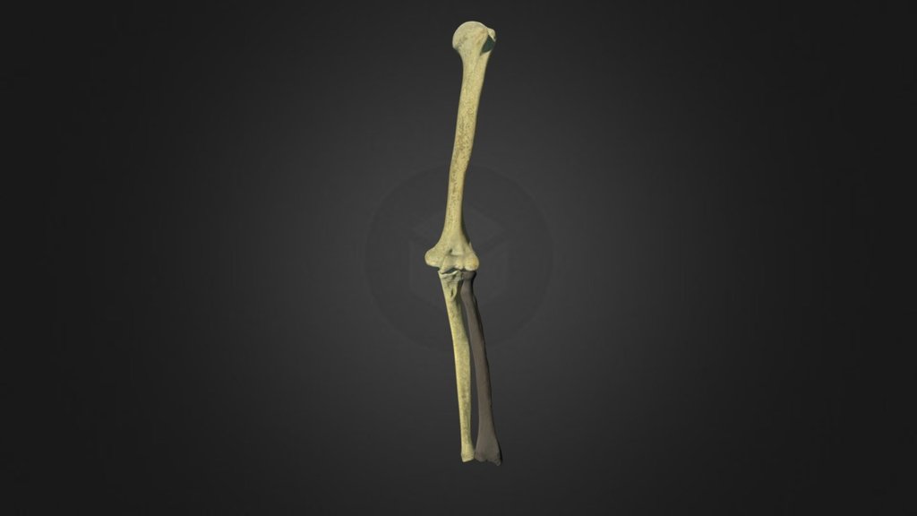 Left Upper Limb