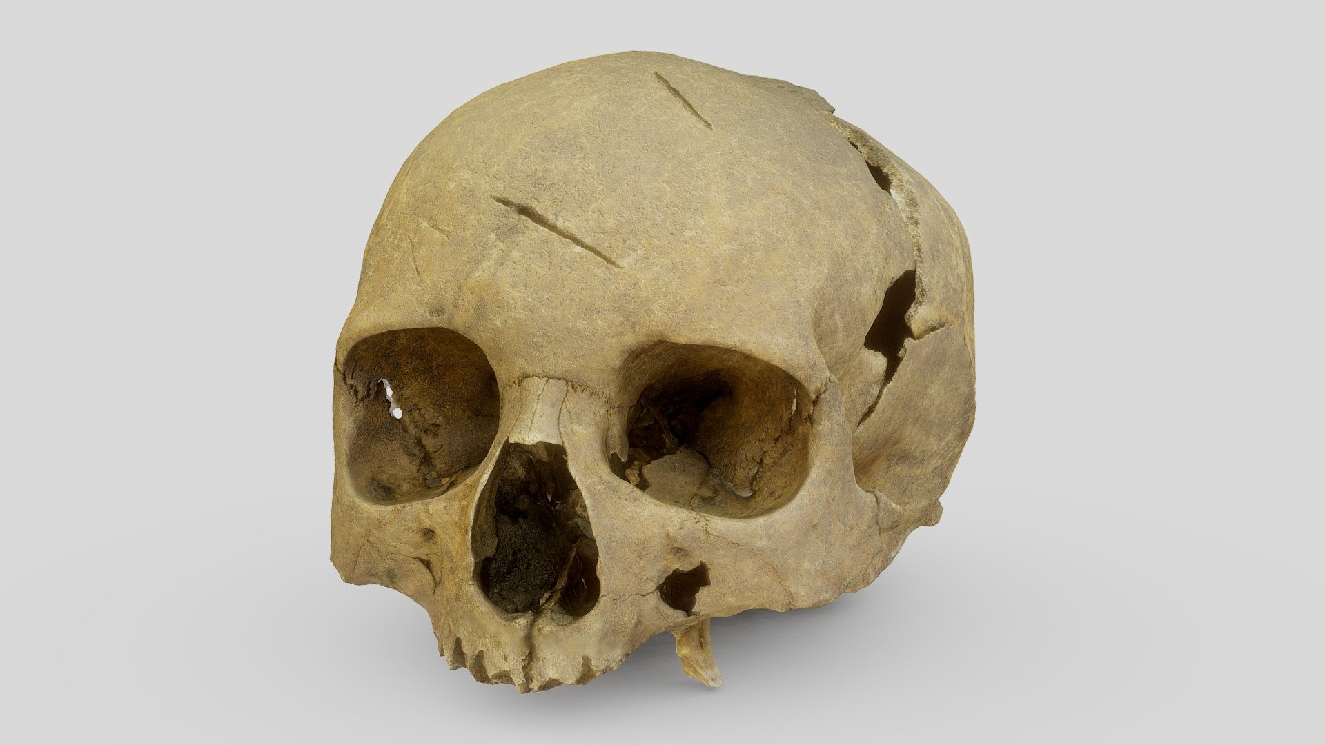 Female skull, injured by a medieval sword (1297)