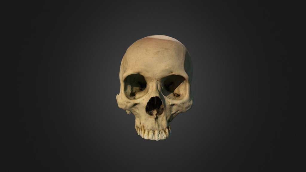 Cranium