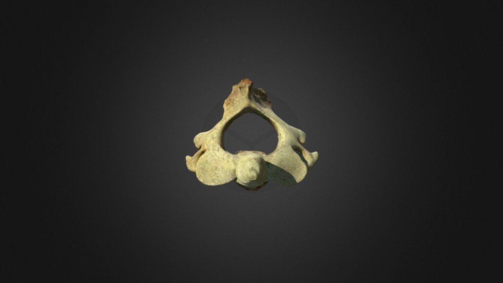 Second Cervical Vertebra